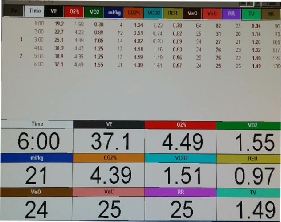 COVOX Rental Metabolic Cart Screen Display